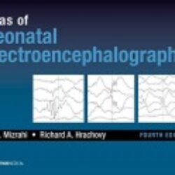 Atlas of Neonatal Electroencephalography, Fourth Edition